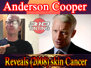 window tinting Los Angeles | Anderson Cooper announcement 2008 skin cancer condition lead to surgery